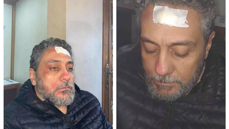 وحدة إضاءة وقعت عليه.. إصابة الفنان تامر فرج فى كواليس تصوير 