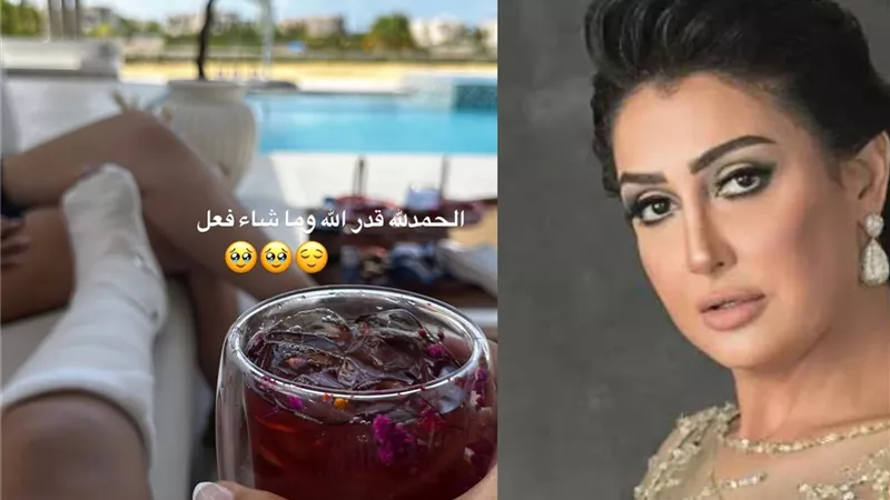غادة عبد الرازق تتعرض لكسر بالقدم وتعلق: الحمد لله، قدر الله وما شاء فعل