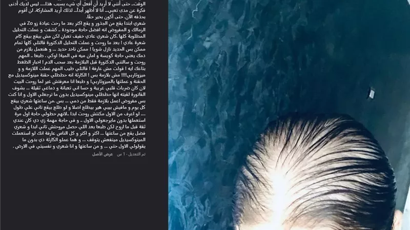  رحمة حسن تصاب بالصلع بسبب حقنة المينوكسيديل.. تعالو نعرف الحكاية (فيديو)