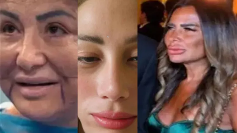 هوس الجمال ينقلب إلى كابوس.. نجمات واجهن 