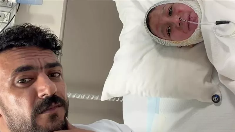 أحمد العوضي يدعم طفلًا أصيب بحروق أثناء إنقاذ والدته من حريق